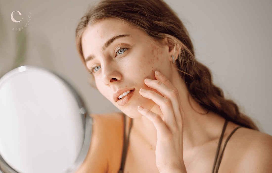 Why Your Skin Isn't Changing (And What To Do About It)